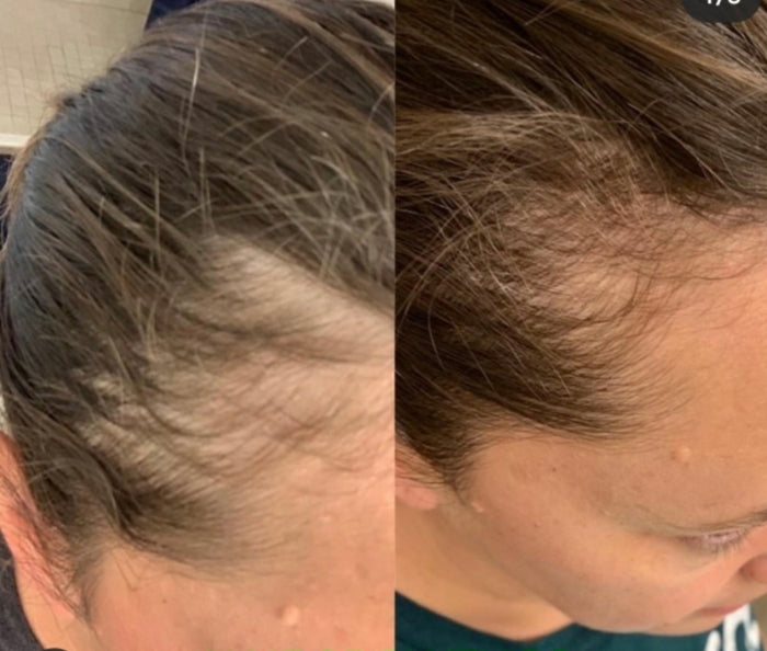 Voor en na resultaat — Pure Nature Glow