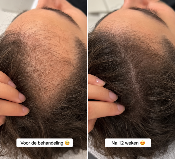 Voor en na resultaat — Pure Nature Glow