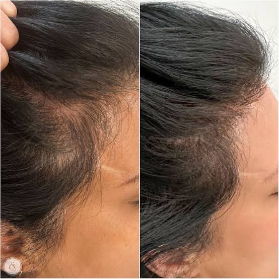 Voor en na resultaat — Pure Nature Glow